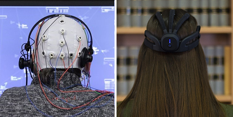 Electroencephalography (EEG)